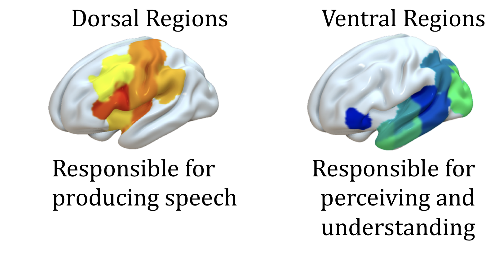 The Anatomy of Aphasia Revisited